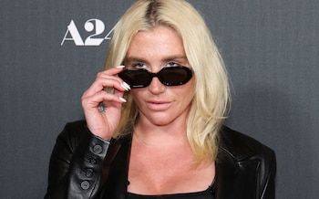 En 2011, Kesha sorprendió al mundo al pedir públicamente dientes a sus fans mediante Twitter, generando cientos de envíos y consolidando una de las colecciones más inusuales del espectáculo (REUTERS/Mario Anzuoni)