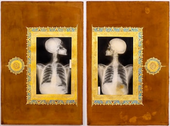 Ahmed Mater es uno de