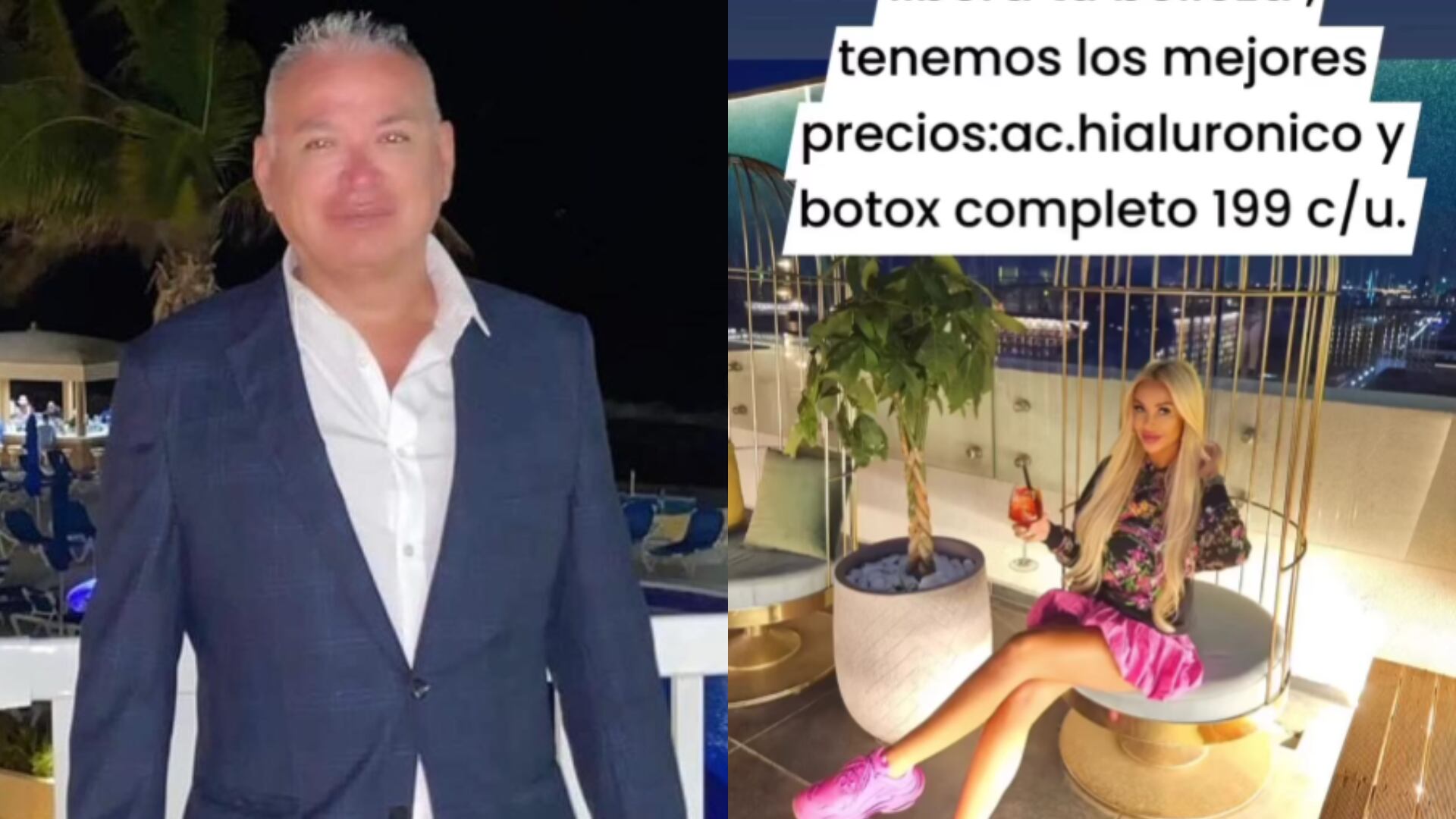 José Lizárraga ofrecía tratamientos de bótox y ácido hialurónico a precios bajos, promocionados en Instagram. (Composición Infobae)