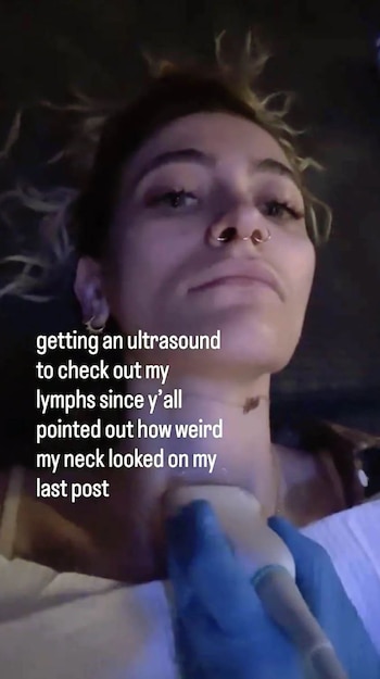 Paris Jackson passou por um exame médico depois que os fãs ficaram preocupados com o formato de seu pescoço.