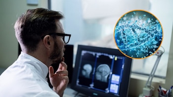 Un estudio sugiere que la ELA y el Parkinson tienen su origen en el intestino: las alteraciones en la microbiota podrían ser el primer paso