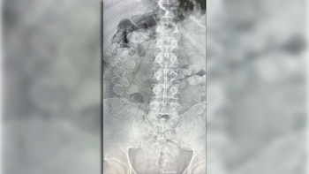 Ataparon a dos mulas que