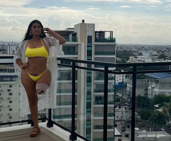 La modelo y presentadora colombiana contó que un automóvil perdió el control en el Malecón de Santo Domingo sobre el pavimento mojado y la atropelló cerca de la acera - crédito yelicacua1/Instagram