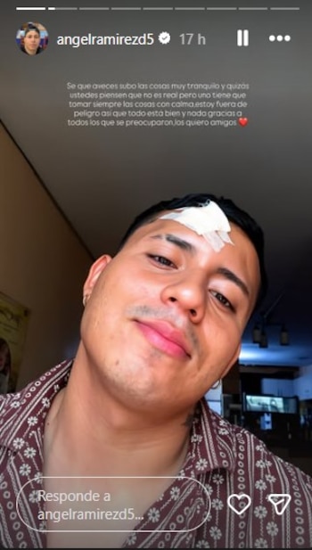 Primer plano del tiktoker Ángel Ramírez sonriendo levemente, con un apósito blanco cubriendo un corte en su frente, vestido con una camisa estampada