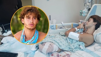 Perdió la pierna en un accidente en Survivor Greece: ahora demanda al reality por 100 millones de dólares