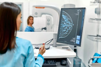 La detección temprana del cáncer de mama aumenta las posibilidades de cura, para ello el método recomendado es la mamografía