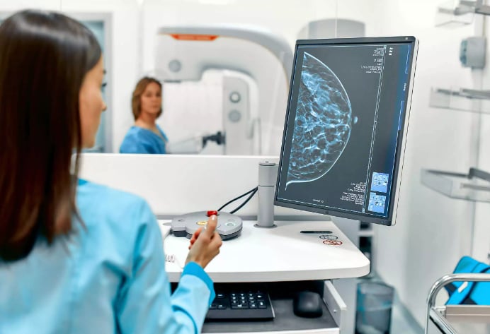 Se calcula que hasta un diez por ciento de los casos de cáncer de mama se deben a mutaciones hereditarias, como BRCA1 y BRCA2