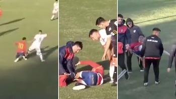 La escalofriante lesión que sufrió un futbolista en el ascenso: la triple rotura en la rodilla que lo tendrá un año sin jugar