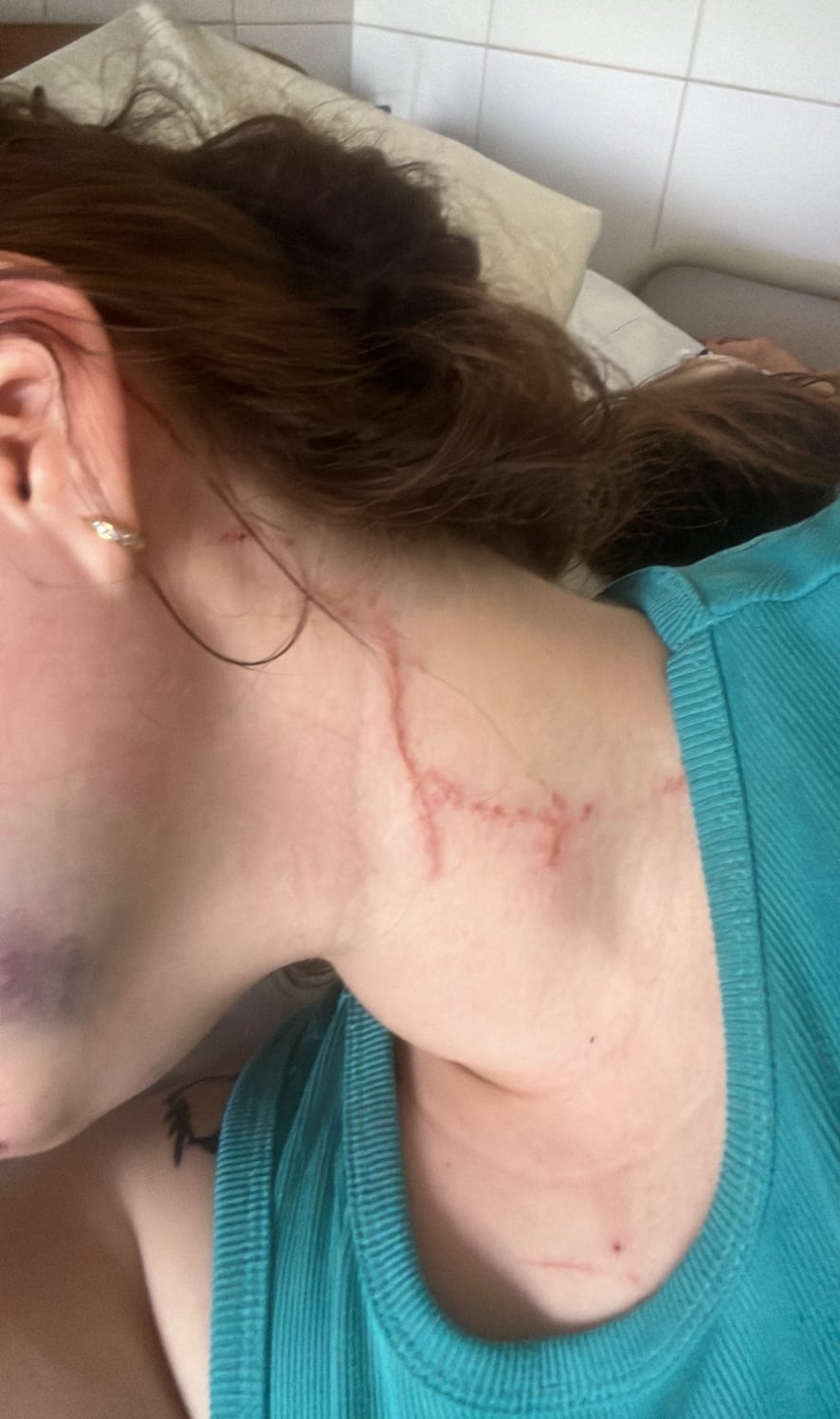 Los cortes y golpes que sufrió la víctima del ataque