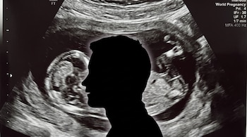 Una silueta negra de una cabeza masculina de perfil sobre una ecografía prenatal que muestra un feto y texto médico técnico.
