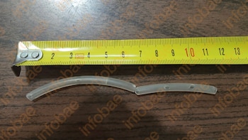 Se operó una rodilla, le olvidaron una cánula de drenaje dentro y tuvo que someterse a otras dos cirugías: condenaron al médico y al sanatorio