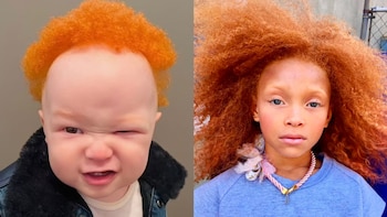 Es común la idea de