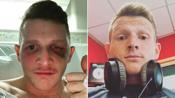 Samuel Ward antes y después