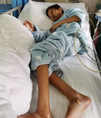 Cuando Wu ingresó al hospital pesaba poco más de 20 kilogramos (Foto: captura de pantalla)