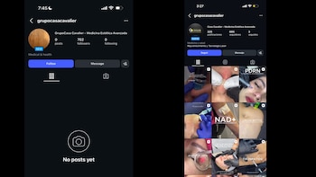 Usuarios en redes sociales señalaron que varias publicaciones y datos relacionados con procedimientos estéticos fueron eliminados tras las denuncias contra Casa Cavalier - crédito Ana María Rodríguez/X y Casa Cavalier/Instagram