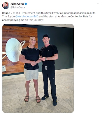 John Cena se afeita la cabeza por completo para optimizar su trasplante capilar