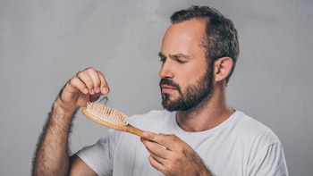 Caída del cabello: 6 tratamientos