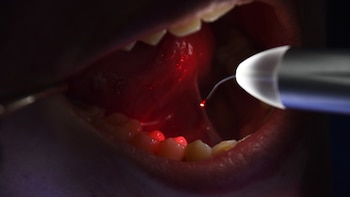 La ‘comunidad de la luz’: cómo la inversión láser está redefiniendo la industria dental en Perú