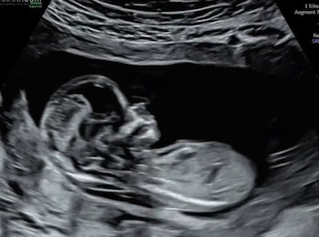 Aunque la pareja no ha revelado más detalles del embarazo, sus seguidores siguen atentos cada novedad sobre el nuevo integrante de la familia - crédito @julieticarestrep0/ Instagram