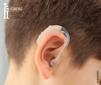 Imagen VSVORQVSBBBZRD6XUE3OAGSG4Y