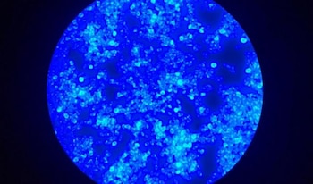 Una imagen del hongo Candida