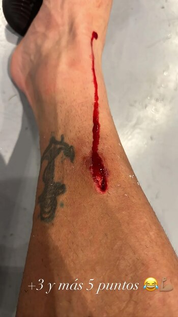 Así quedó la pierna de