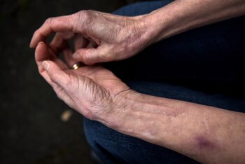 Tras una cirugía de reemplazo