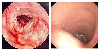 La tráquea de Sonia Sein