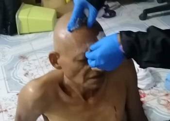 Paramédicos auxiliaron a Jaime Vargas