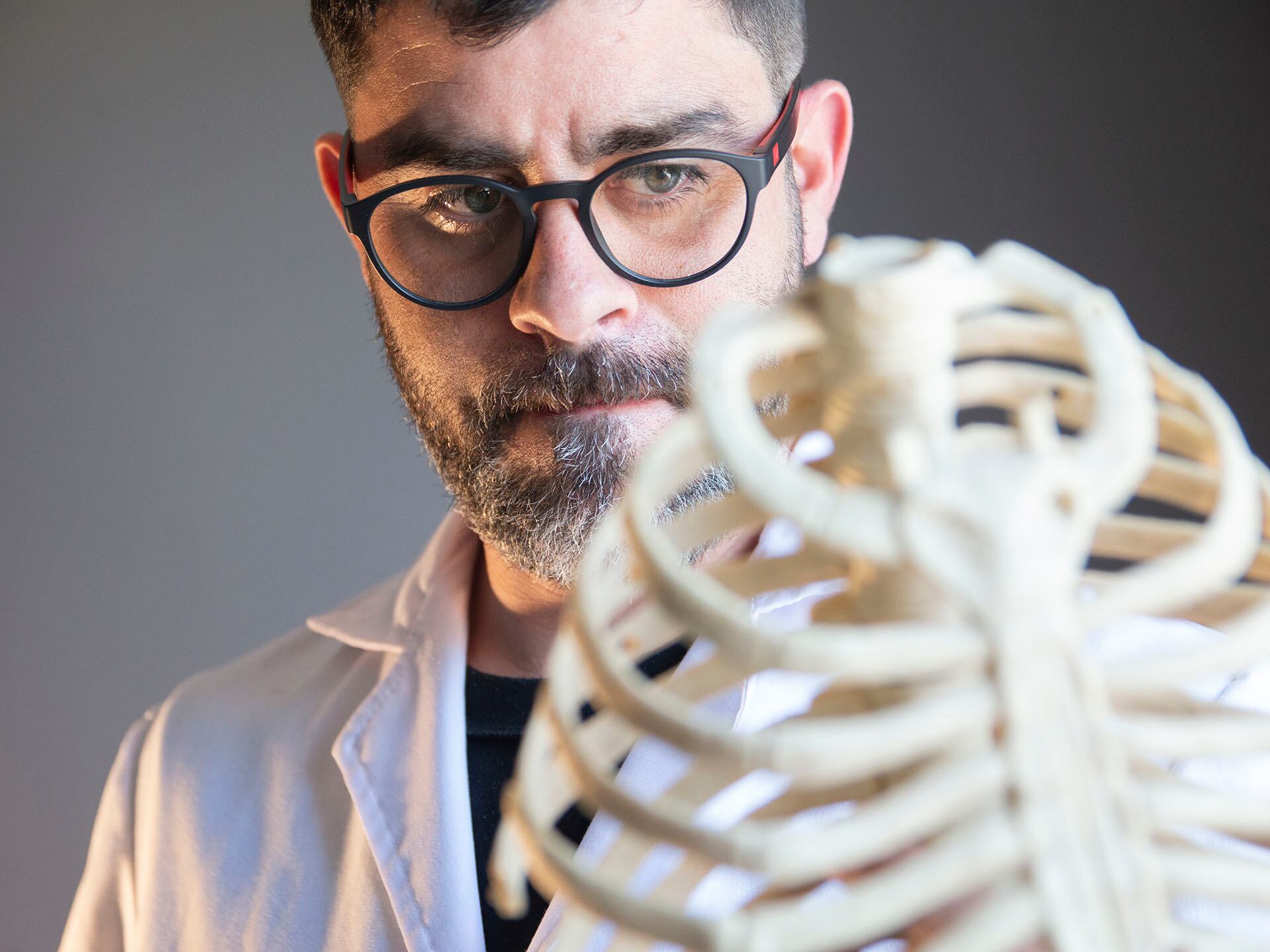 Enfermedades como el síndrome de Marfan, la celiaquía y la artritis reumatoide aumentan la vulnerabilidad a fracturas óseas