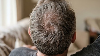 Por qué se forman los