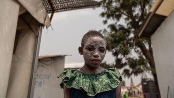 ¿Por qué las vacunas contra