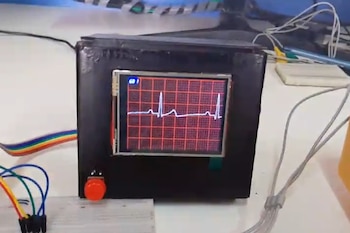 Prototipo de electrocardiograma portátil hecho
