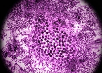 Micrografía electrónica en tonos morados con numerosas partículas virales redondas y oscuras y estructuras celulares sobre un fondo pálido