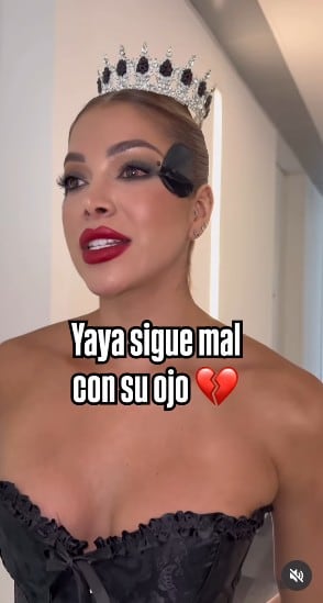 Un golpe durante el entrenamiento provocó una lesión en el ojo de Yaya Muñoz - crédito @dahianlorena/Instagram