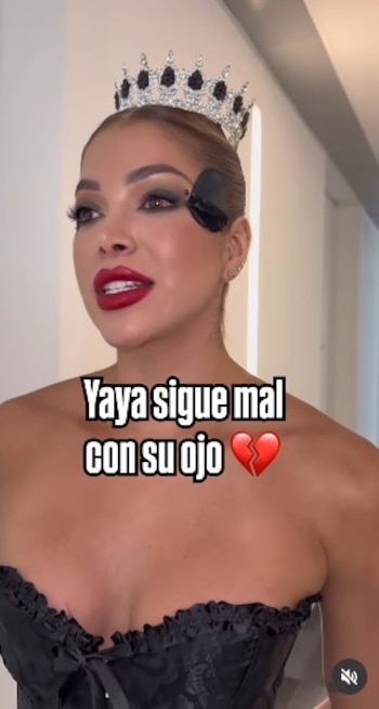 Un golpe durante el entrenamiento provocó una lesión en el ojo de Yaya Muñoz - crédito @dahianlorena/Instagram