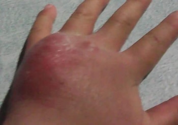 Aparentemente así lucía la mano