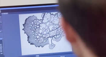 La muestra 73001/2, recolectada por