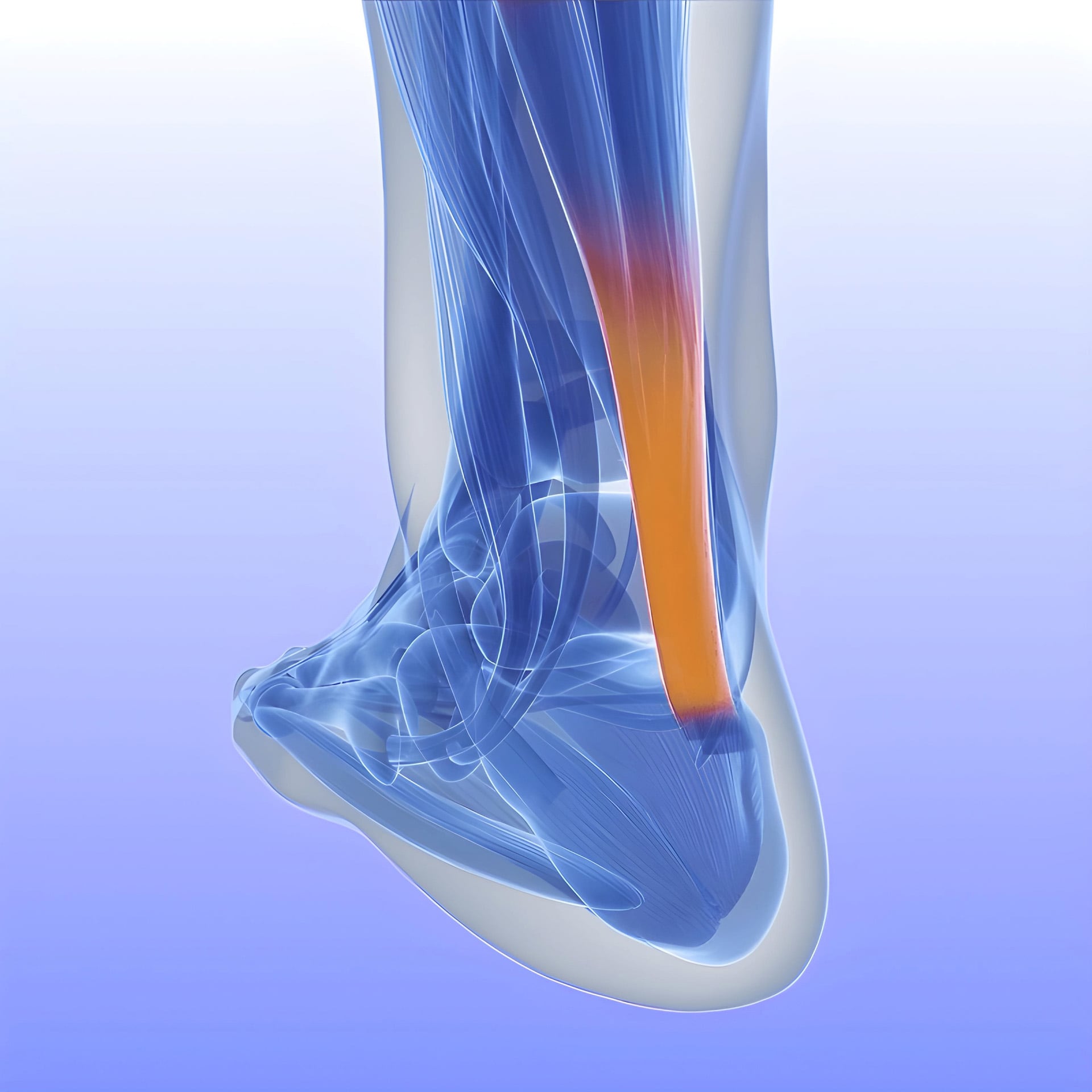 La aplicación de células madre mesenquimales autólogas permitió a todos los pacientes tratados caminar de inmediato