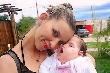 Una mujer rubia con ojos azules abraza tiernamente a un bebé dormido con manchas rosadas en su ropa, ambos en un exterior diurno