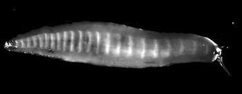 Imagen del pie de una