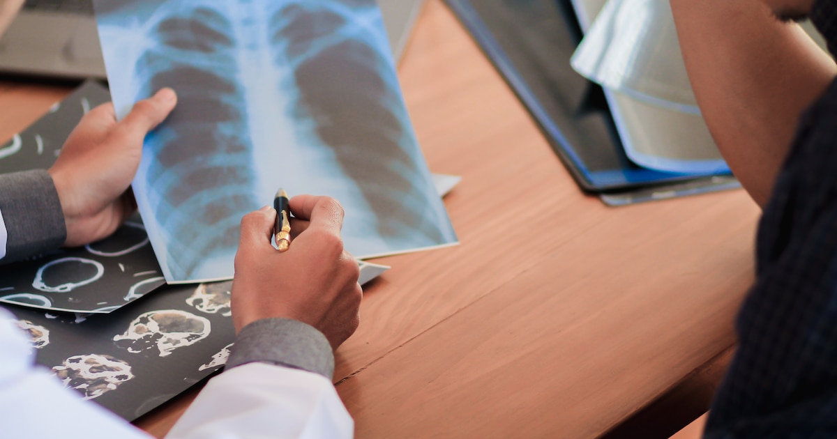 Rayos X: ¿Son Realmente Peligrosos para tu Salud? La Verdad que Debes Saber