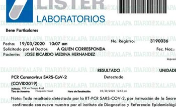 Resultado para COVID-19 (Foto: Diario