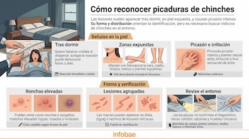 Infografía con ilustraciones de lesiones cutáneas, un dormitorio, marcas en la piel y personas inspeccionando un colchón con linterna.