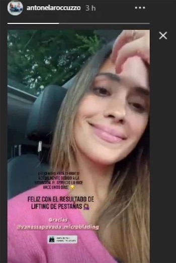 Antonela Roccuzzo mostró su lifting