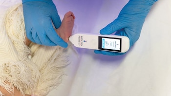 Así funciona el dispositivo brasileño