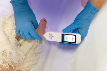 El dispositivo Preemie-Test ha sido