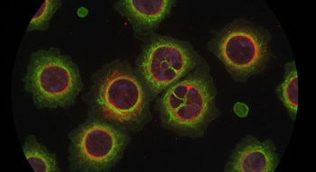 Células microscópicas con núcleos púrpura, citoplasma verde y puntos rojos en un fondo negro.