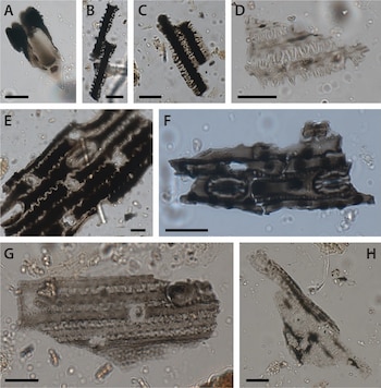 Ocho imágenes microscópicas de fragmentos biológicos, etiquetadas de A a H, sobre un fondo claro con partículas difusas. Cada imagen incluye una barra de escala negra
