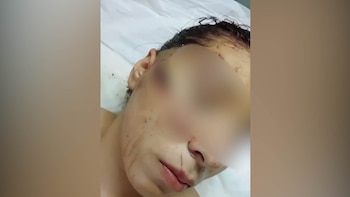 Ataque a tiros en una escuela de Santa Fe: el antecedente de una chica apuñalada en patota